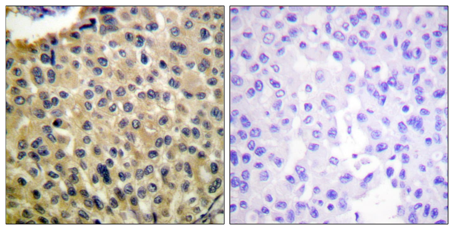 c-Kit / CD117 Antibody (phospho-Tyr703)