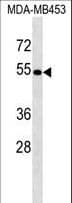 Polyclonal Rabbit anti-Human ACCS / ACS Antibody (aa224-250, WB)
