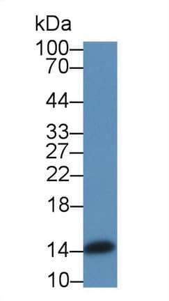 Angiogenin / ANG Antibody (aa25-142)