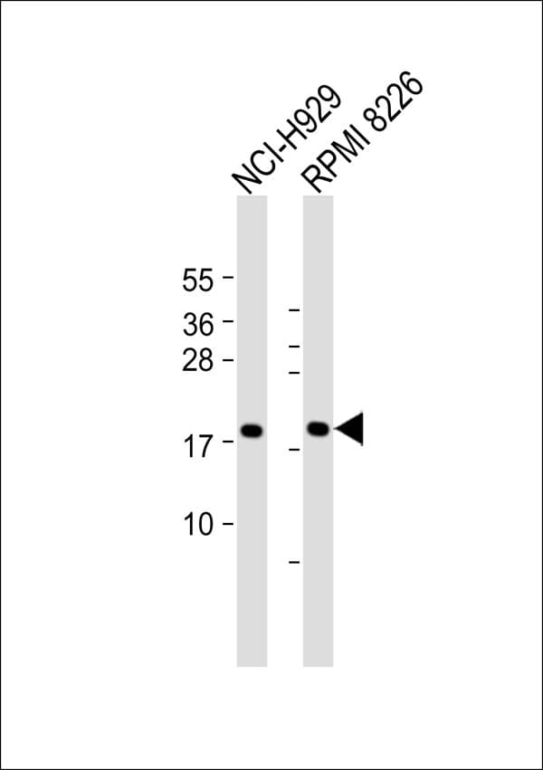 Polyclonal Rabbit anti-Human CD300LD Antibody (WB)