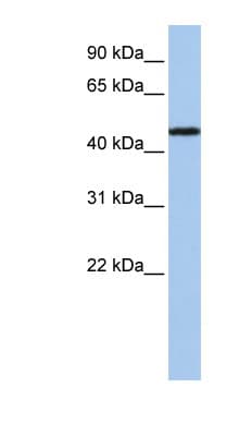 P2RX2 / P2X2 Antibody (aa108-157)