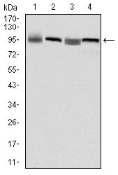 IHC-plus™ EEF2 / Elongation Factor 2 Antibody (clone 5B6)