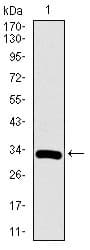 IHC-plus™ RUNX3 Antibody (clone 2B3)