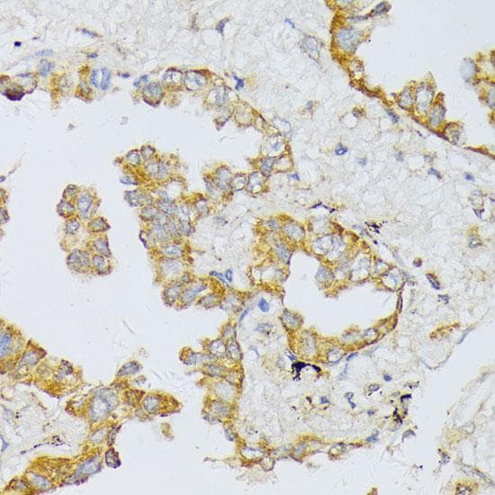 ART1 /CD296 Antibody