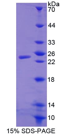 Mouse PS20 / WFDC1 Protein (Recombinant His-T7)