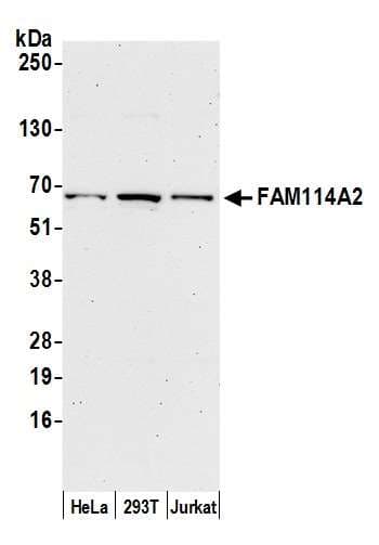 Polyclonal Rabbit anti-Human FAM114A2 / C5orf3 Antibody (aa25-75, WB)