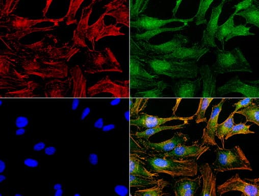 Monoclonal Mouse anti-Human NME1 / NM23 Antibody (clone UMAB93, IHC, IF, WB)