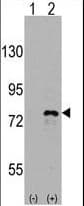 DDX3 / DDX3X Antibody (aa456-485)