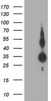 ZFP36 / Tristetraprolin Antibody (clone OTI3C3)