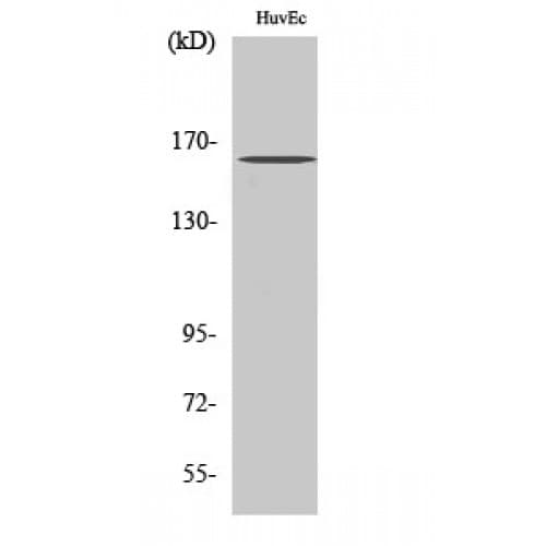 CML / BCR Antibody (120-200 aa)