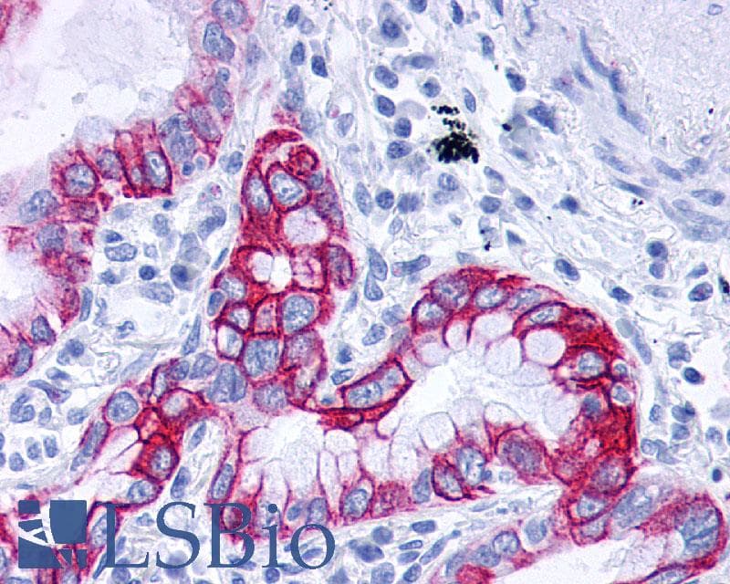 PathPlus™ Polyclonal Rabbit anti-Human GPBAR1 / TGR5 Antibody (C-Terminus, IHC)