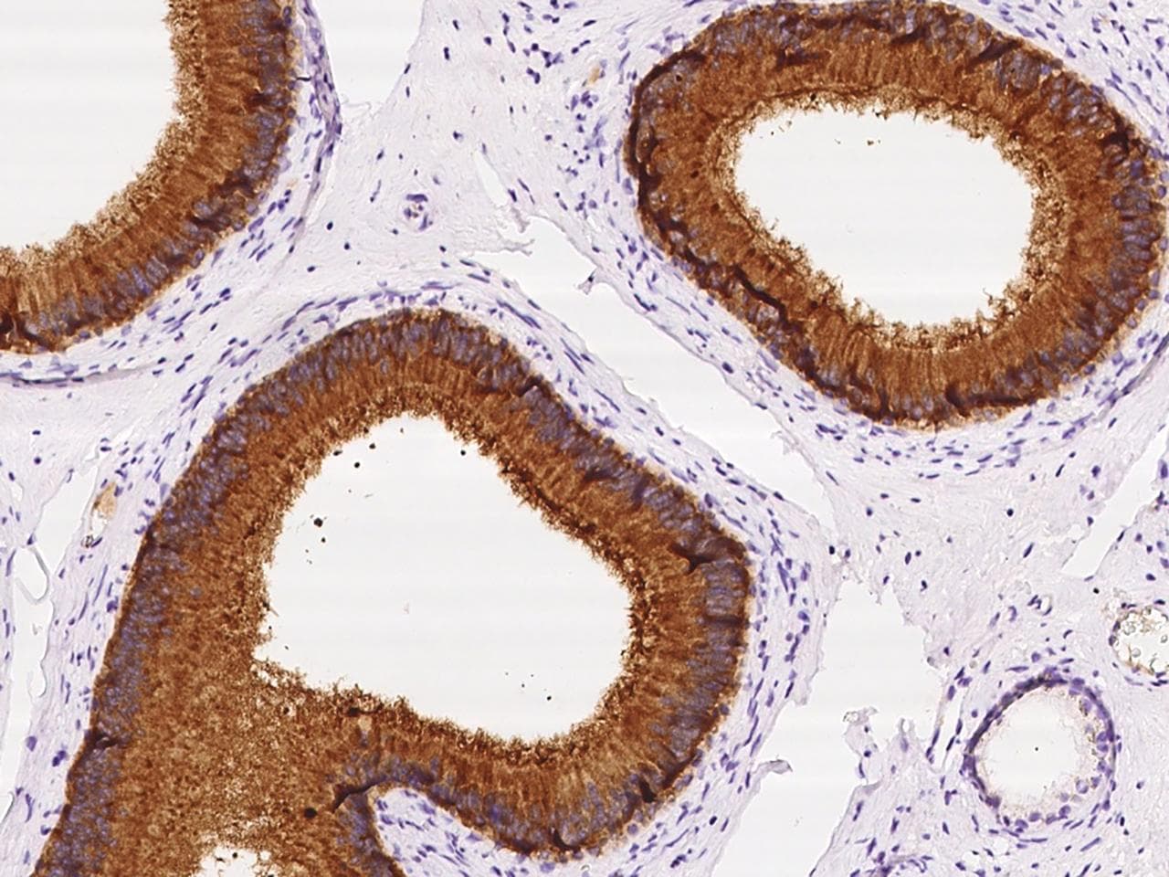 Polyclonal Rabbit anti-Human SPINK2 Antibody (IHC)