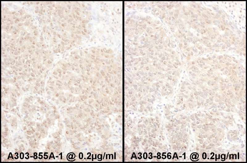 PSMD4 / RPN10 Antibody (aa250-300)
