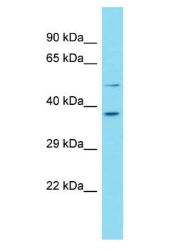 Polyclonal Rabbit anti-Human FAM187B Antibody (aa29-78, WB)