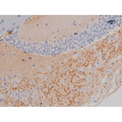 SNCA / Alpha-Synuclein Antibody (phospho-Ser129)