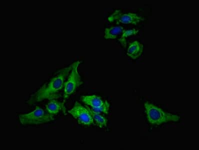 IHC-plus™ Polyclonal Rabbit anti-Human LIMS1 / PINCH Antibody (IHC, IF, WB)