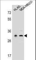 Polyclonal Rabbit anti-Human PRSS3 / Trypsin 3 Antibody (aa136-163, IHC, WB)