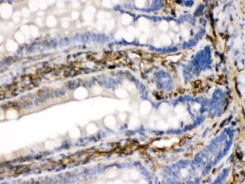 FGF1 / Acidic FGF Antibody