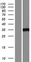 HDAC11 Protein (Over-Expression Lysate Myc-DDK (Flag))