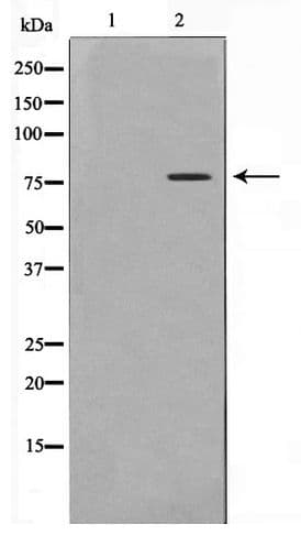 Polyclonal Rabbit anti-Human CREBL1 / ATF6B Antibody (WB)
