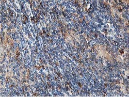 Monoclonal Mouse anti-Human ATG3 Antibody (clone OTI2C12, IHC, IF, WB)