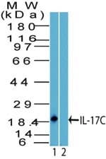 Polyclonal Rabbit anti-Human IL17C Antibody (aa80-130, WB)