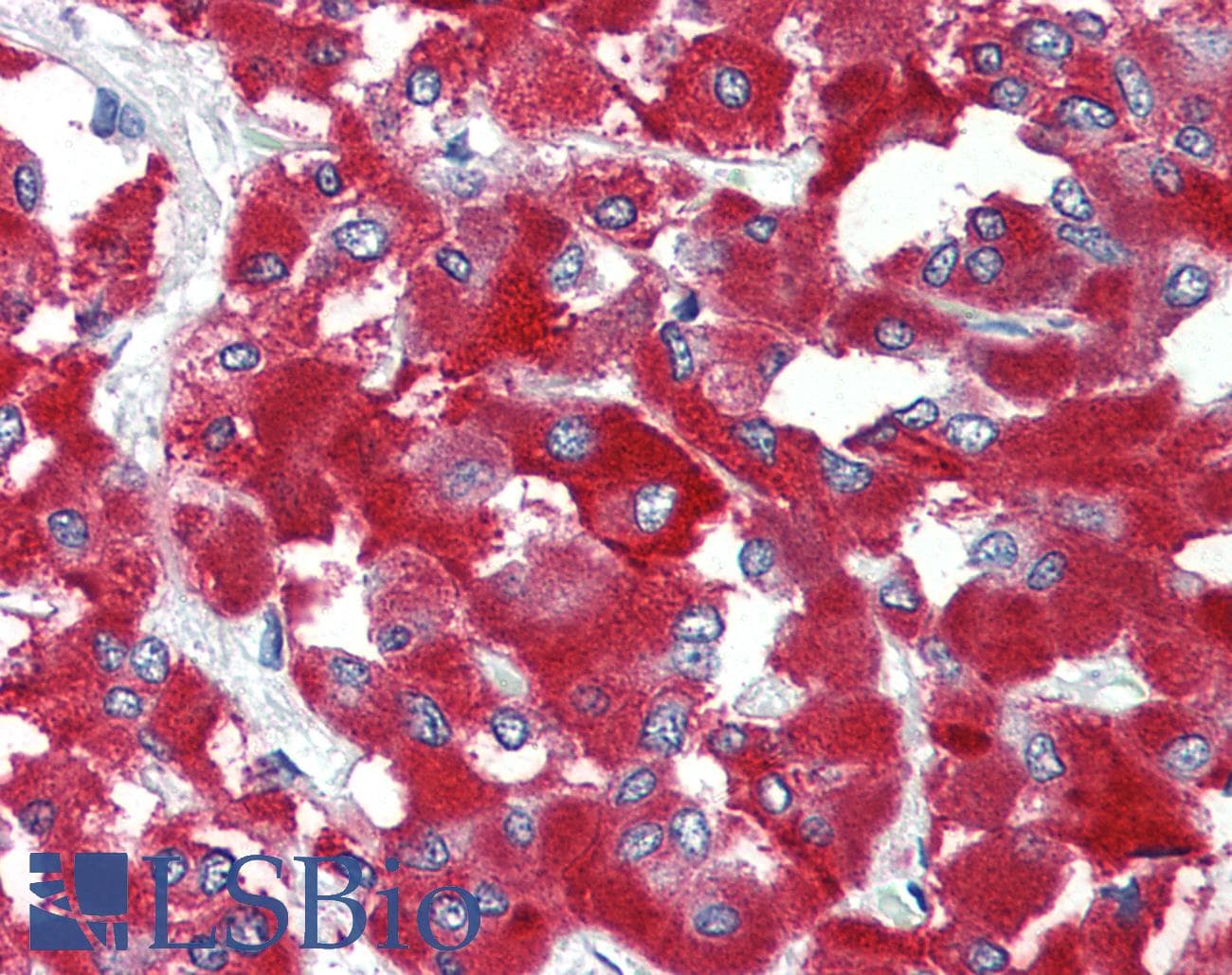 IHC-plus™ Polyclonal Rabbit anti-Human THEM6 / C8orf55 Antibody (N-Terminus, IHC)