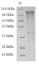 Human RFWD2 / COP1 Protein (Recombinant 6His, N-terminus)