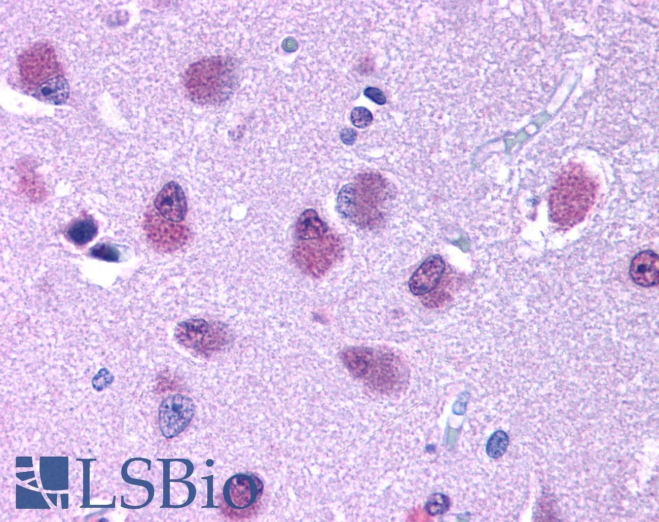 IHC-plus™ Polyclonal Rabbit anti-Human BRS3 Antibody (Cytoplasmic Domain, IHC)