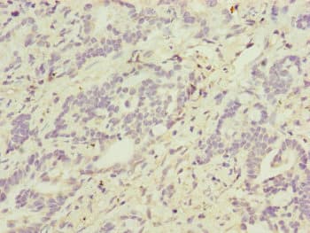 ATP5D Antibody