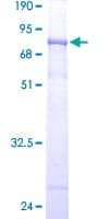 Human WDR41 Protein (Recombinant GST)