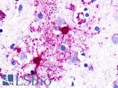 PathPlus™ Polyclonal Rabbit anti-Human NMUR1 Antibody (Cytoplasmic Domain, IHC)