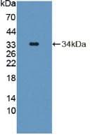 Tyrosine Aminotransferase Antibody