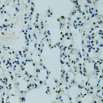 AHR Antibody