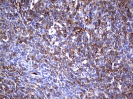CD30 Antibody (clone OTI16H5)