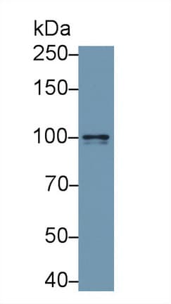 NRP1 / Neuropilin 1 Antibody (aa27-143)