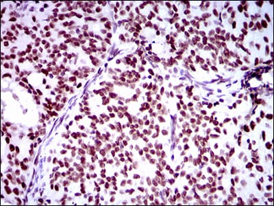Monoclonal Mouse anti-Human RING1 Antibody (clone 8C12F4, aa79-263, IHC, WB)