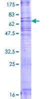 Human SMS2 / SGMS2 Protein (Recombinant GST)