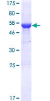 Human RSPH9 / C6orf206 Protein (Recombinant GST)