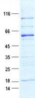 Human MYOZ2 / CS-1 Protein (Recombinant GST, N-terminus + His, C-terminus)
