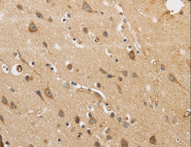 Polyclonal Rabbit anti-Human ARF6 Antibody (IHC, WB)