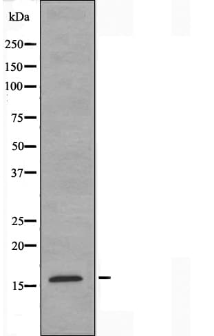 TSC22D1 / TSC22 Antibody
