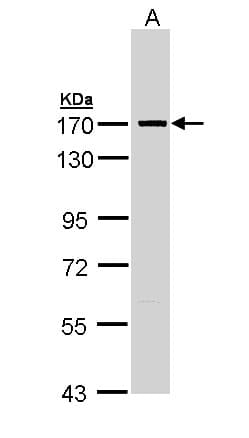 PathPlus™ Polyclonal Rabbit anti-Human SMC1A / SMC1 Antibody (aa1-248, IHC, WB)