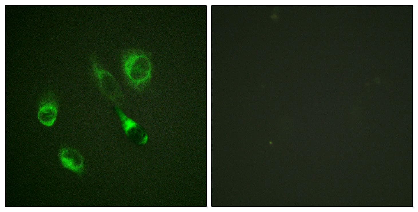 Polyclonal Rabbit anti-Human EPH Receptor A2+A3 Antibody (phospho-Tyr588/596, IF, WB)