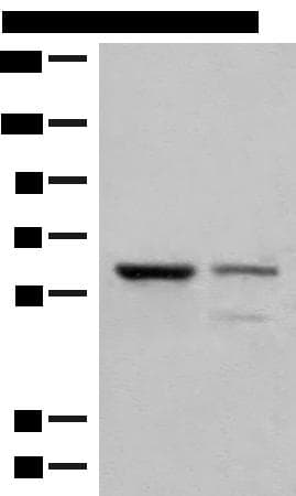 HNF1A / HNF1 Antibody