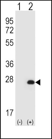 HPRT1 / HPRT Antibody (aa65-94)