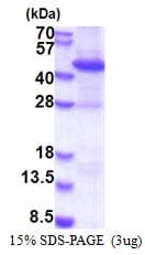 Human RAD51B Protein (Recombinant His)