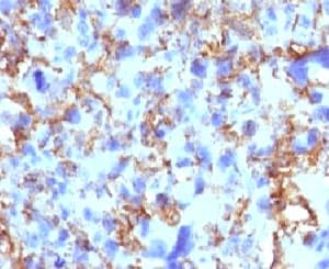 HLA-DRB1 Antibody (clone MHDRb2)