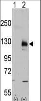 Polyclonal Rabbit anti-Human TRPM8 Antibody (aa926-956, IHC, WB)