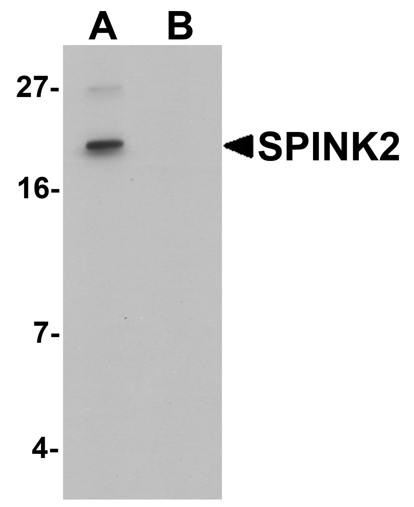 IHC-plus™ SPINK2 Antibody